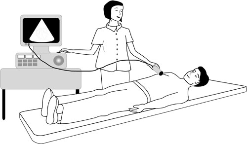 Echo Echocardiogram