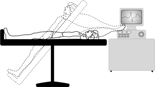 Tilt-table testing